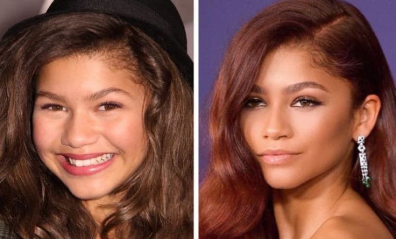 Source Photo : HNW / PictureLux/PictureLux/agefotostock/East News, © zendaya / Instagram