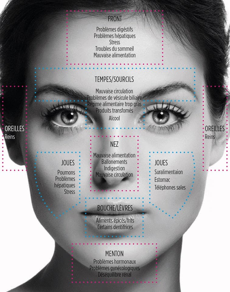 définir la cause de son acné face mapping 